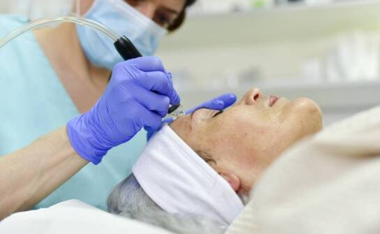 Dlaczego mikrodermabrazja jest idealnym rozwiązaniem dla tłustej skóry?