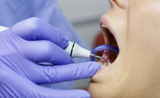 Jak zastosowanie wewnątrzustnej kamery wspomaga leczenie?