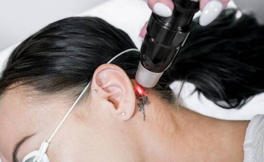 Czy laserowe usuwanie permanentnego makijażu wpływa na późniejsze kosmetyczne zabiegi?