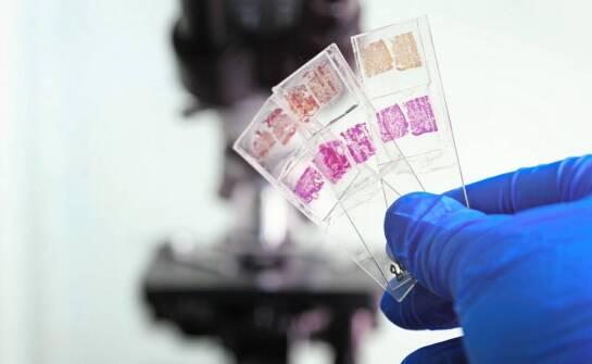 Wpływ niedoczynności przysadki na hormonalne zdrowie pacjenta