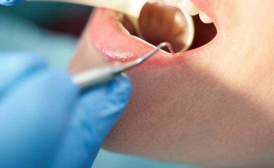 Procedury polerowania zębów a ich wpływ na wygląd i zdrowie szkliwa