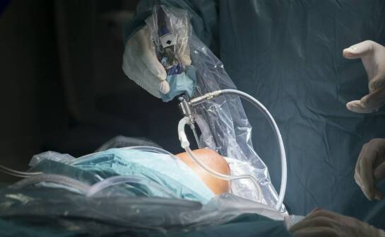 Artroskopia barku: jak zapewniać bezpieczeństwo pacjenta podczas zabiegu?