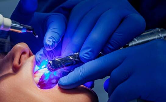 Jak injection flow zmienia standardy estetyki zębów w stomatologii?