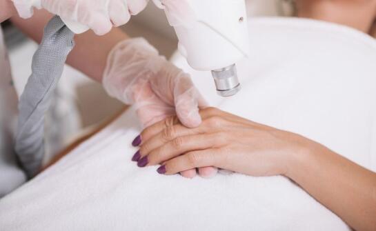 Zalety usuwania brodawek przy użyciu lasera CO2: nowoczesne podejście do dermatologii