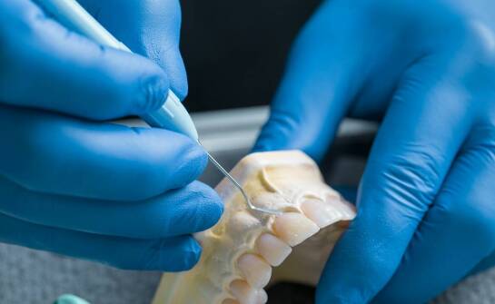 Jakie są etapy przygotowania do zabiegu zakładania licówek?