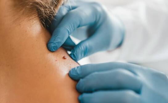 Jakie zabiegi są wykonywane w przypadku podejrzenia przednowotworowych zmian?