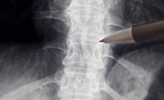 Znaczenie obrazowej diagnostyki w leczeniu schorzeń kręgosłupa