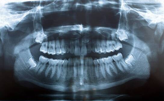 Rola zaawansowanej diagnostyki w leczeniu szczękowo-twarzowych wad