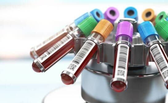 Cena wirówki do krwi a techniczne parametry – co wpływa na koszt zakupu?