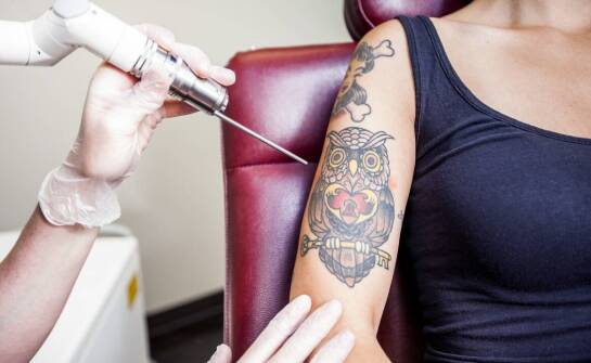 Czy tatuaż można usunąć całkowicie? Możliwości laseroterapii.
