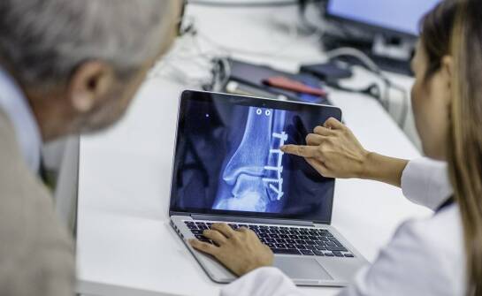 Jakie są korzyści zdrowotne wynikające z podkolanowej osteotomii?