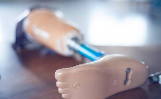 Jakie są różnice między tymczasowymi a stałymi protezami nogi?