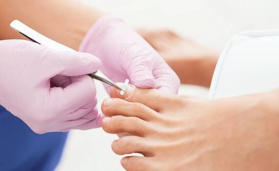 Jakie korzyści przynosi pedicure dla osób z cukrzycą?