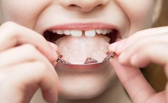 Czym różni się ortodontyczne leczenie dzieci i dorosłych?