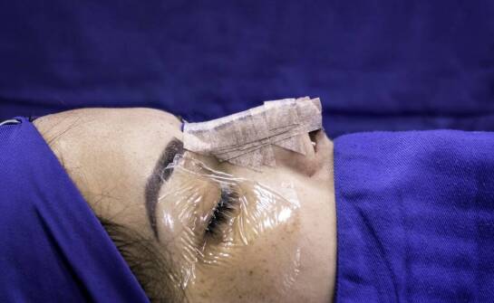 Jakie zdrowotne aspekty należy rozważyć przed korektą nosa?