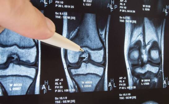 Jakie schorzenia narządów ruchu można wykryć dzięki RTG?