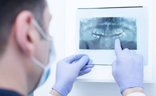 Jakie korzyści niesie rentgen zatok dla pacjentów z przewlekłymi infekcjami?