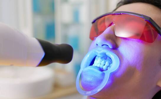 Wybielanie zębów jako element kompleksowego leczenia stomatologicznego