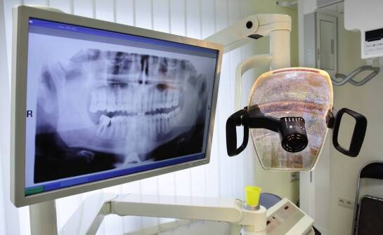 Zalety cyfrowej diagnostyki w pracy dla implantologa