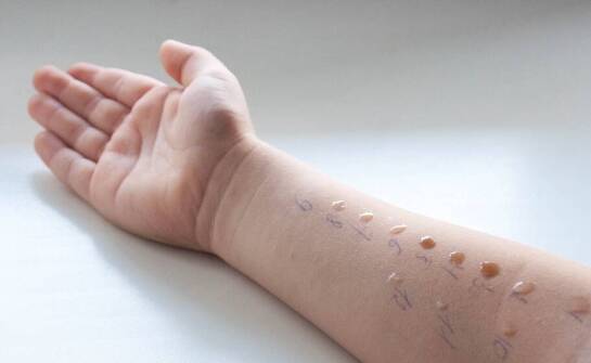 Jak testy alergiczne mogą wspierać holistyczne podejście do zdrowia u dziecka?