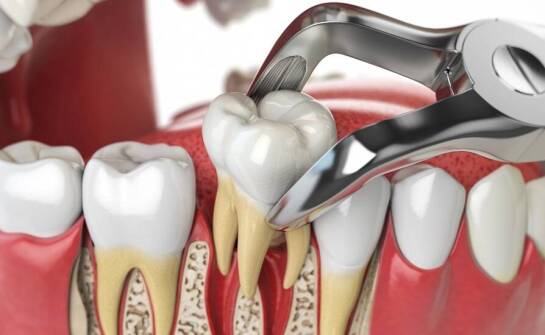 Jakie są najnowsze trendy w stomatologicznej chirurgii?