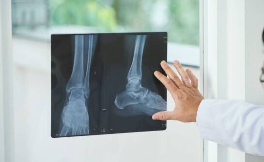 Jak cyfrowe RTG pomaga w planowaniu ortopedycznego leczenia?