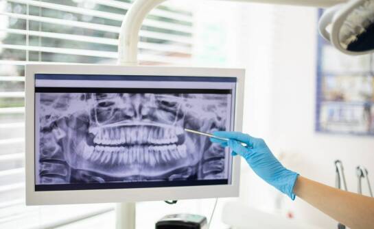Rola rentgenodiagnostyki w planowaniu leczenia stomatologicznego na Woli