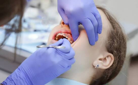 Jak dziecięca stomatologia wspiera korektę wad zgryzu u dzieci?