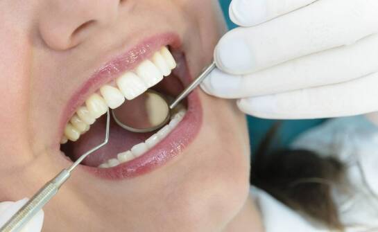 Jak usuwanie nazębnego kamienia wpływa na świeżość oddechu?