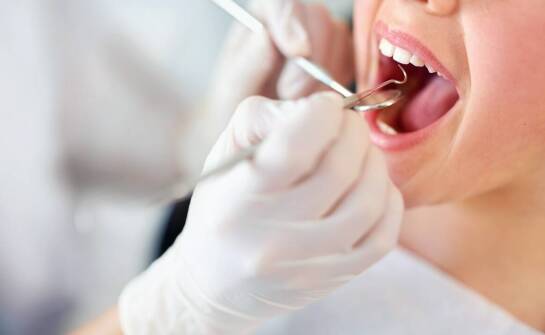 Efekty leczenia próchnicy u dorosłych: co można osiągnąć?