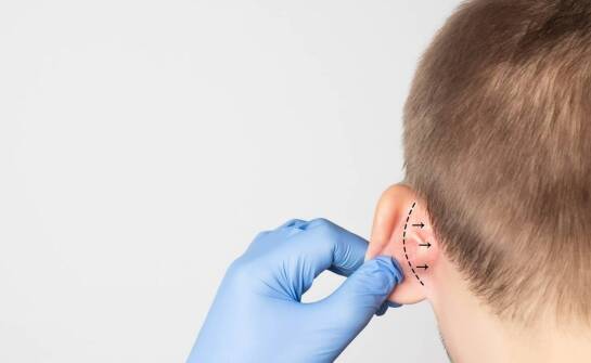 Plastyka uszu – jak poprawia komfort życia u pacjentów?