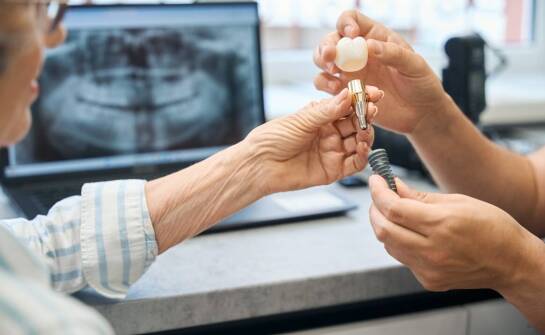 Jakie są kluczowe etapy leczenia implantologicznego?