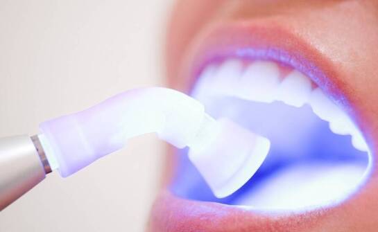 Jak nowoczesne technologie wpływają na skuteczność wybielania zębów?