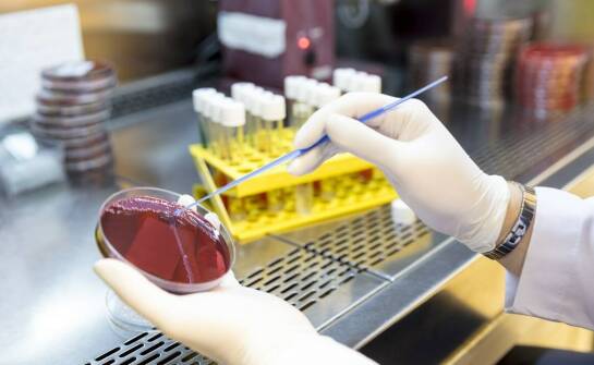 Badania na grzybicze infekcje: kompleksowa diagnostyczna oferta