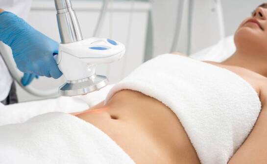 Czy karboksyterapia jest skuteczna w walce z rozstępami?