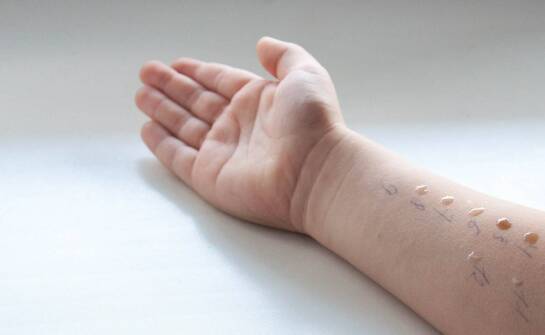 Jakie są wskazania do usunięcia znamienia u dzieci?