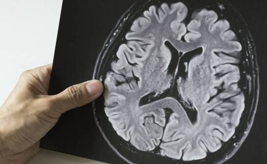 Czy istnieją metody profilaktyki oponiaka węchowej rynienki?