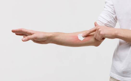 Zastosowanie lidokainy w maściach do oparzeń