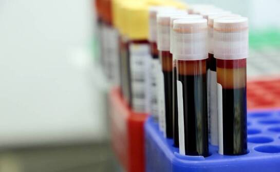 Diagnostyka laboratoryjna a zdrowie układu krążenia: badania, które mogą uratować życie.