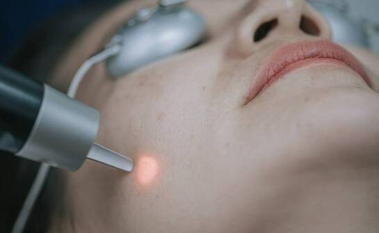 Jak długo utrzymują się efekty odmładzania za pomocą lasera CO2?