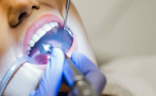 Nowoczesne metody leczenia przebarwień na zębach w gabinetach stomatologicznych