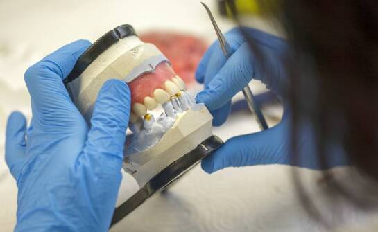 Kombinowane uzupełnienia jako rozwiązanie dla złożonych przypadków protetycznych