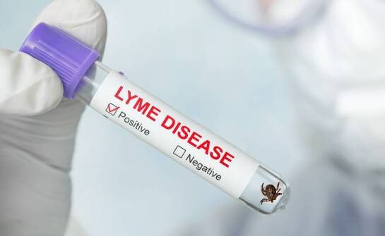 Testy na boreliozę a naturalna medycyna: jak łączą się w diagnostyce?