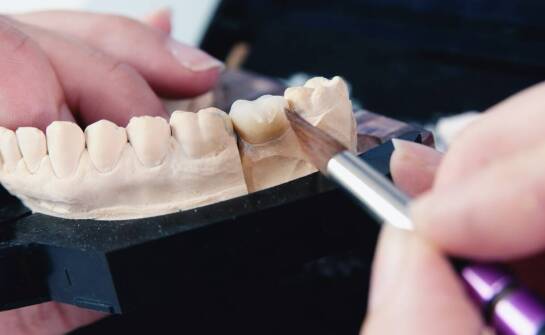 Zalety stosowania porcelanowych koron w estetycznej stomatologii