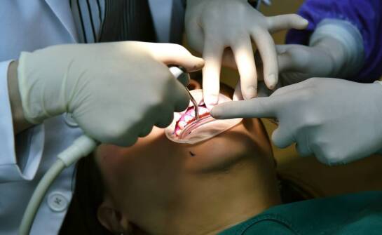 Proces gojenia po ekstrakcji ósemek – czego można się spodziewać?