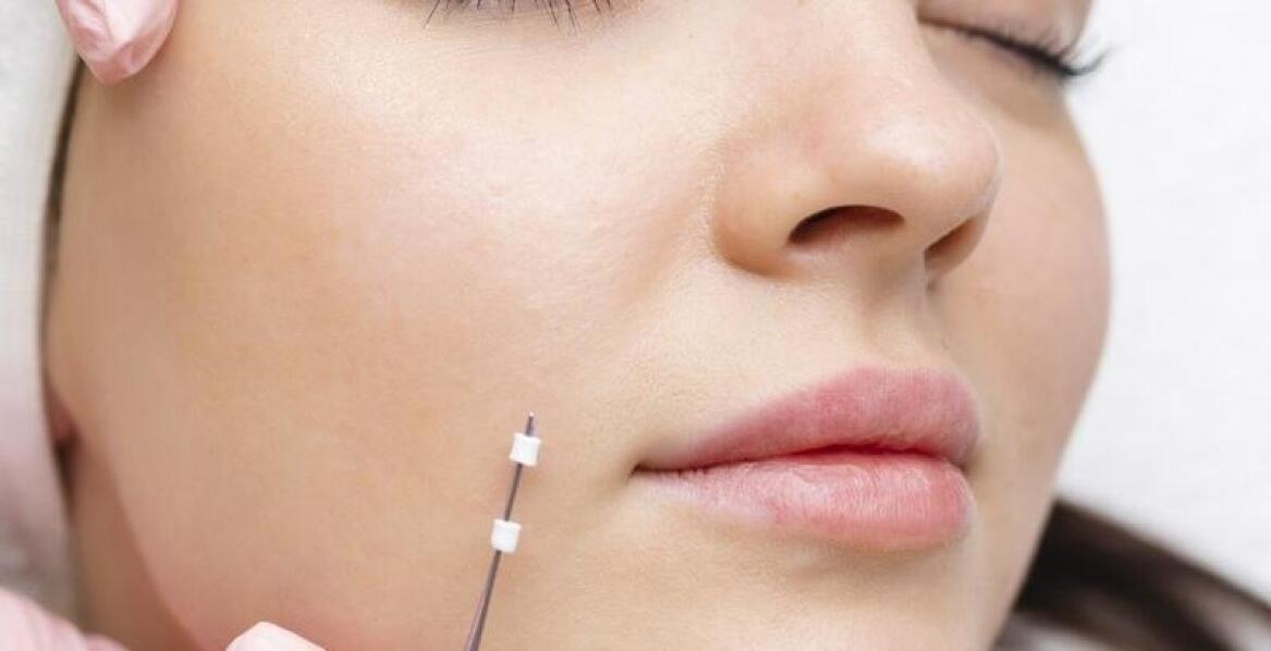 Igłowa mezoterapia jako metoda stymulacji produkcji kolagenu