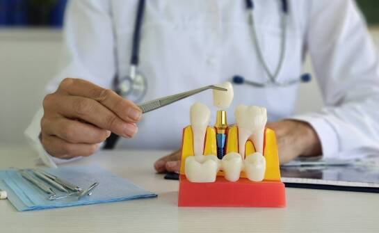 Nowoczesne techniki implantologiczne stosowane przez dentystę na Zaspie.