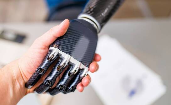 Wpływ mioelektrycznej technologii na rozwój protez ręki