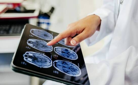 Rola neurologii w leczeniu rozsianego stwardnienia