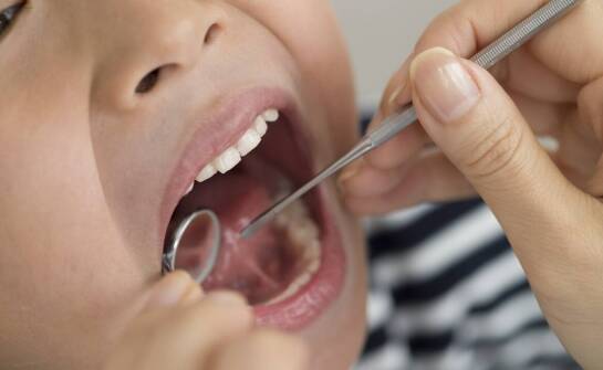 Próchnica zębów u dzieci. Jak ją się rozpoznaje?